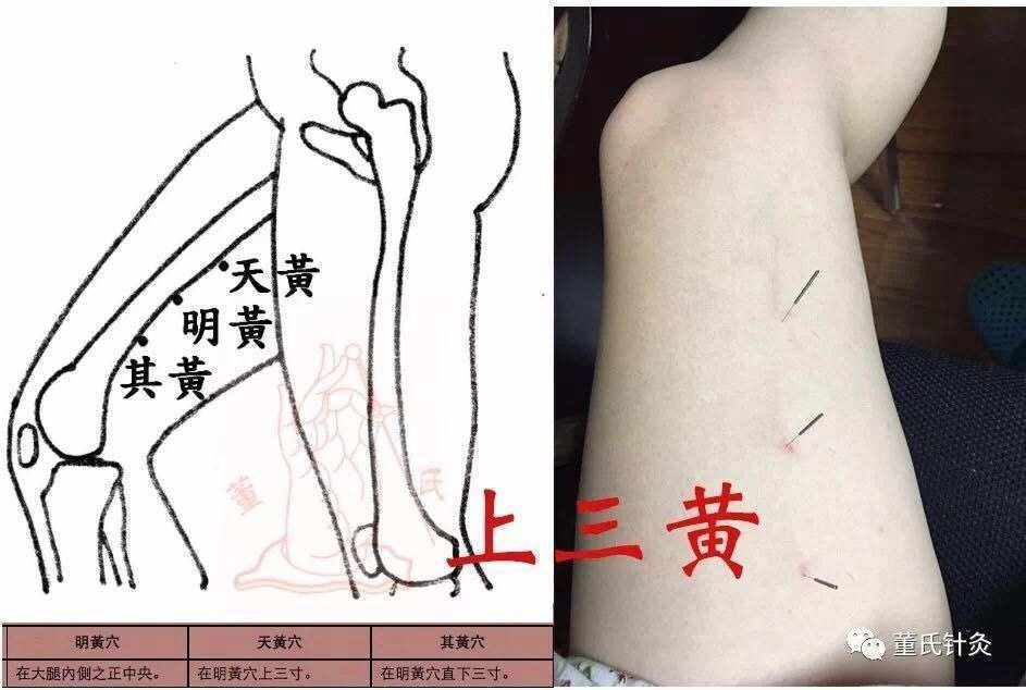 如何知道自己被打窍(女人身上有仙家的五个特征)